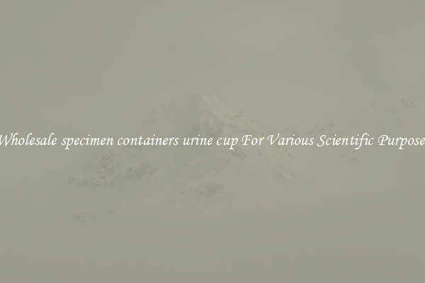 Wholesale specimen containers urine cup For Various Scientific Purposes